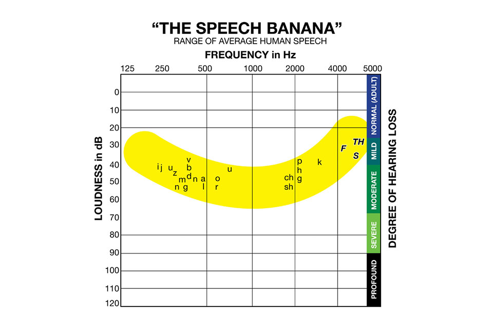 Speech Banana