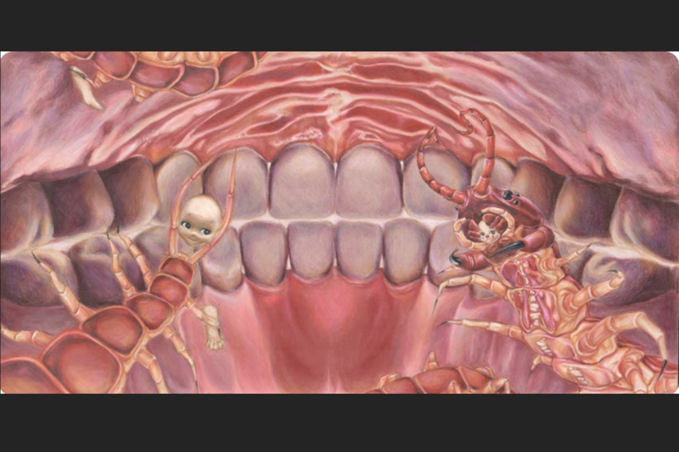 A drawing of an open mouth with visible teeth and several worms crawling among them.